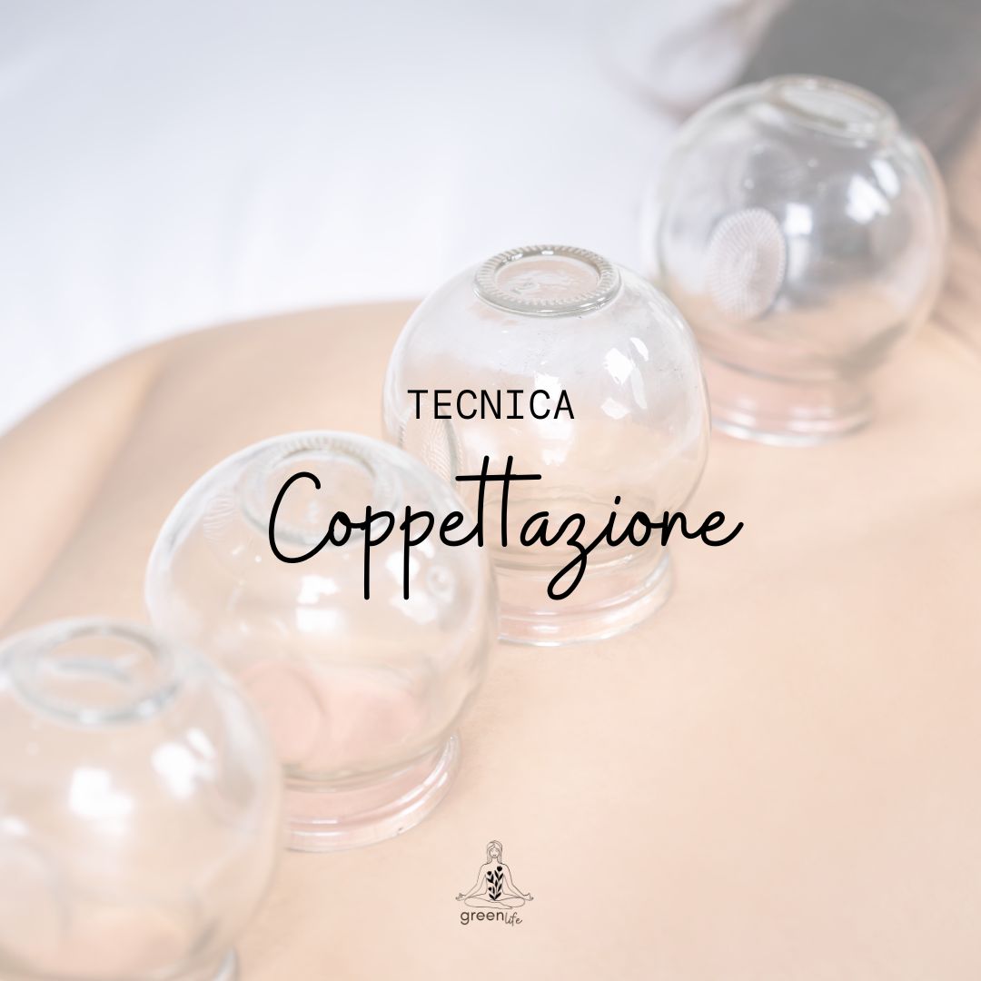 Coppettazione