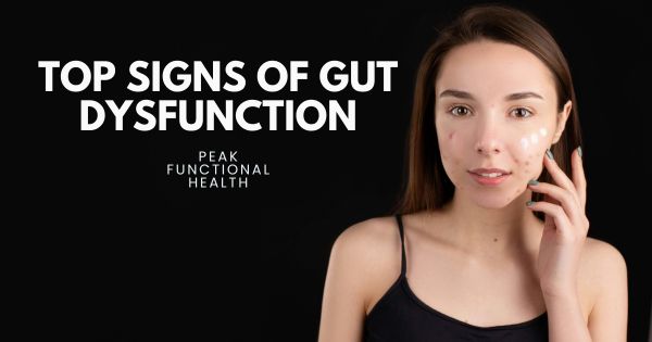 10 Signs Your Digestion Needs Support