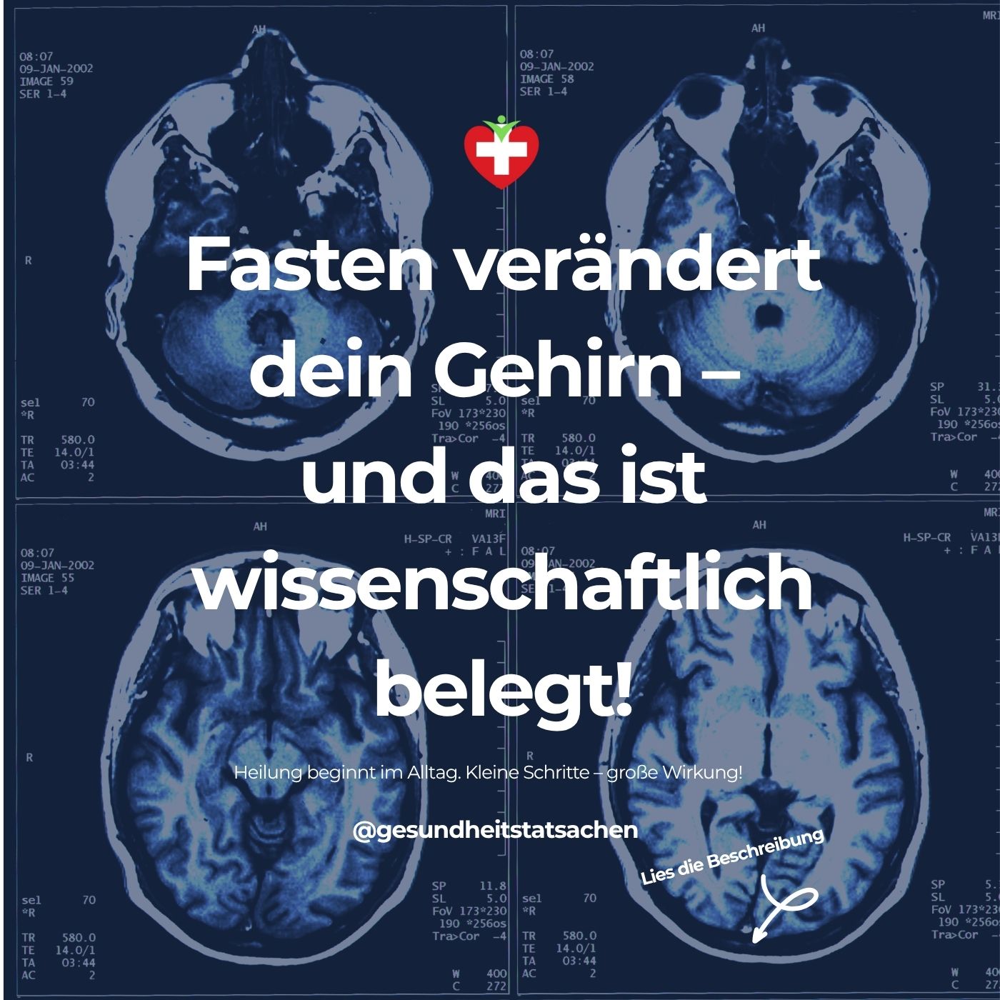 Fasten als Gehirn-Reset: 🧠🥣 Wie Intervallfasten dein Denkorgan messbar verändert – und warum das revolutionär ist!