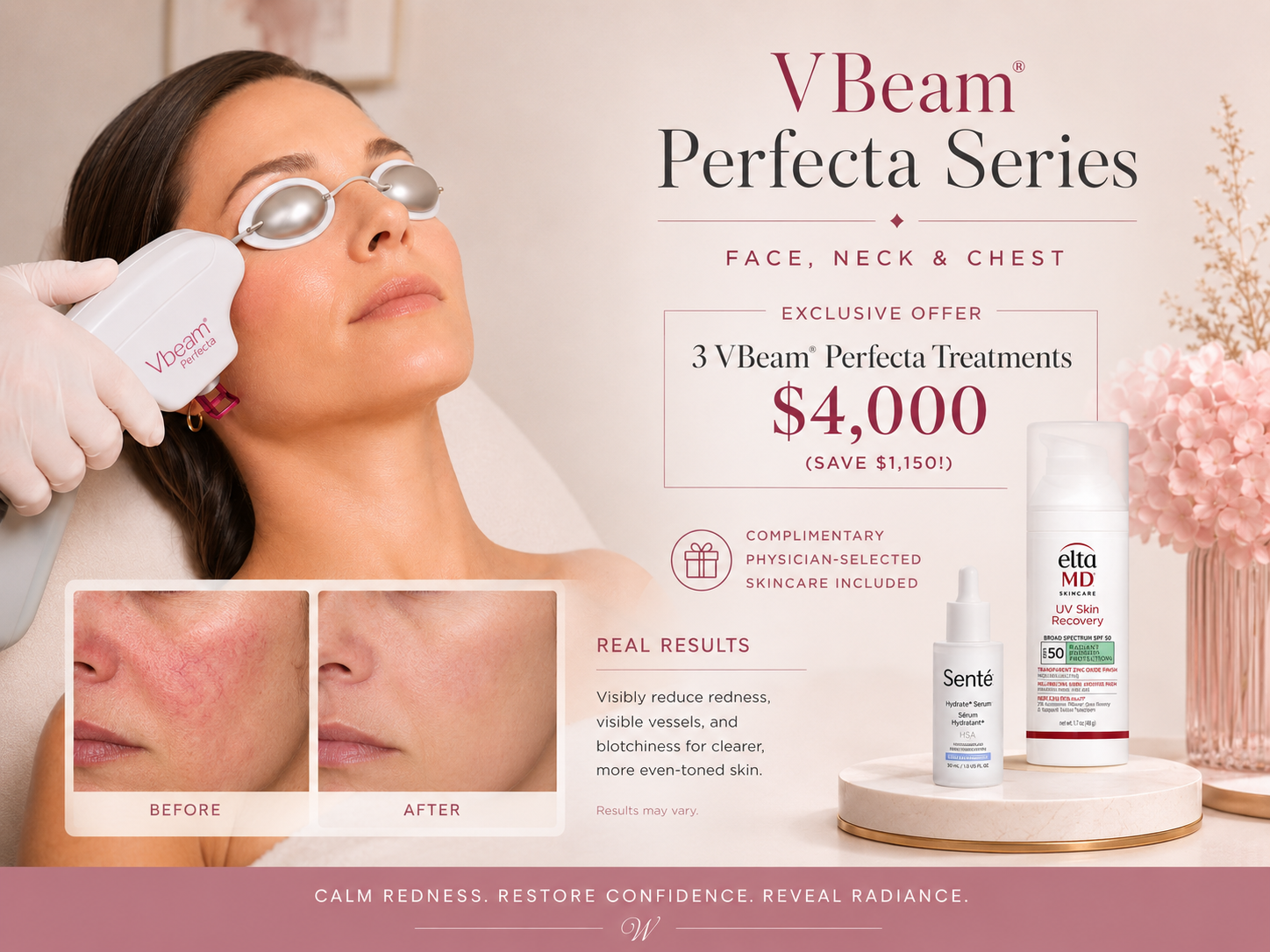 VBeam Perfecta Series