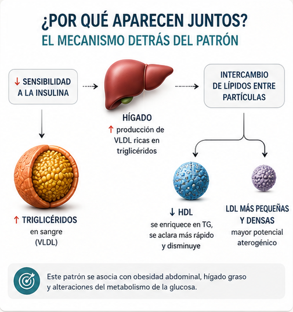 Esquema del mecanismo: al disminuir la sensibilidad a la insulina, el hígado aumenta la producción de VLDL ricas en triglicéridos; el intercambio de lípidos entre partículas hace que suban los triglicéridos, baje el HDL y las LDL sean más pequeñas y densas.
