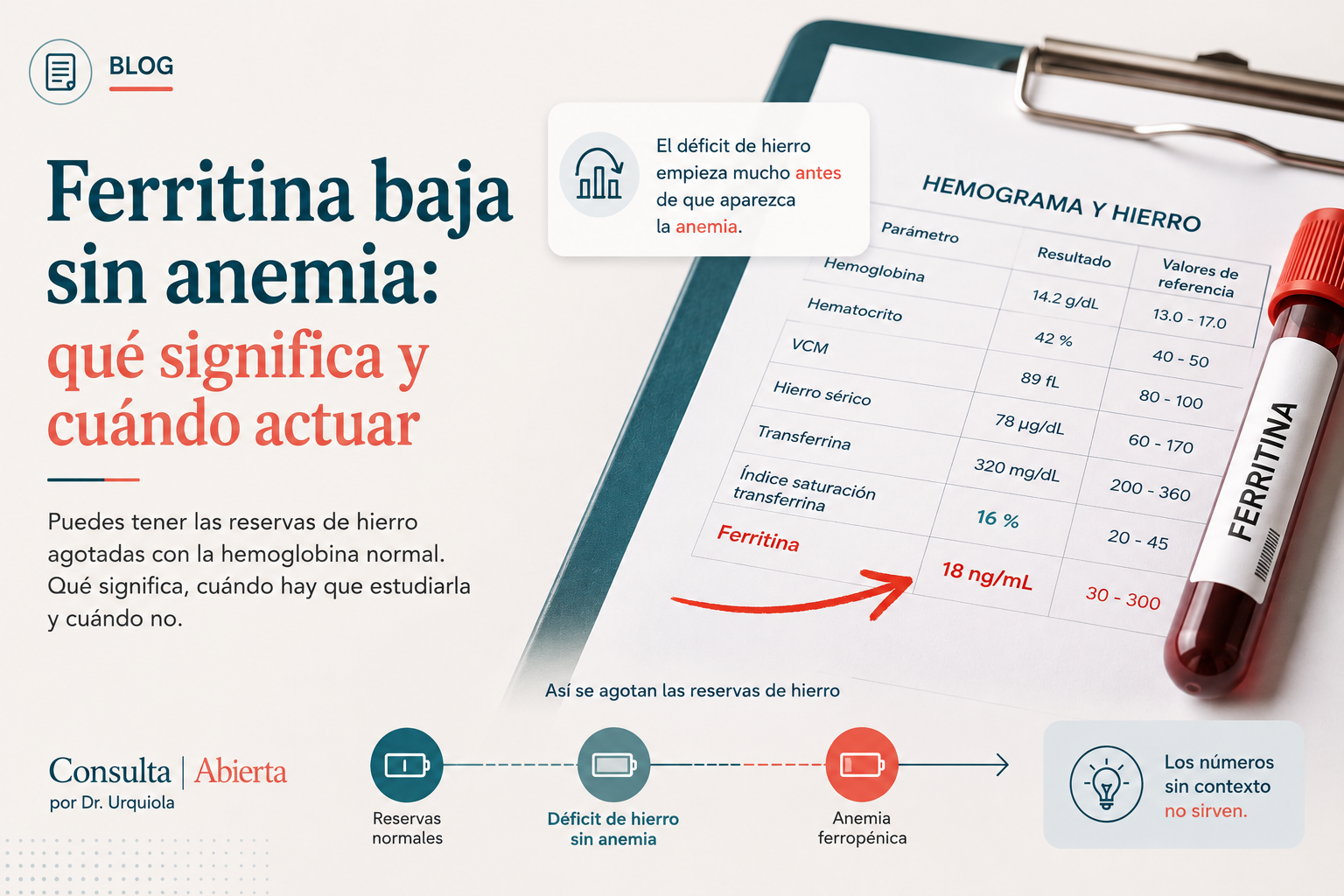 Ferritina baja sin anemia: qué significa y cuándo actuar