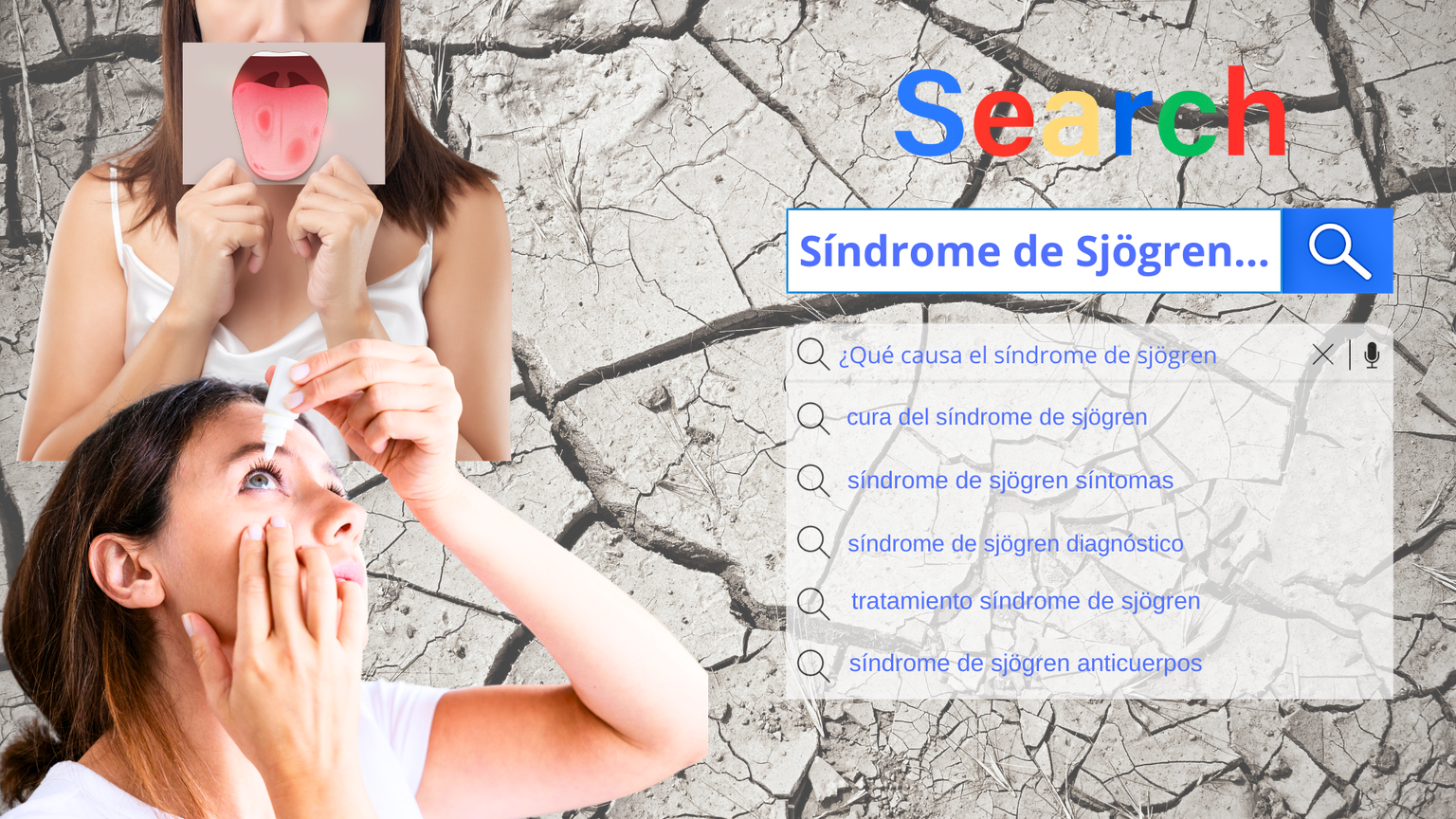 Síndrome de Sjögren: cuando el cuerpo cierra sus propios grifos