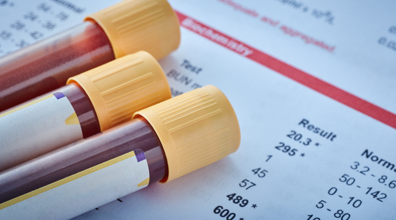 Why 'Normal' Bloods Don’t Mean Normal Hormones