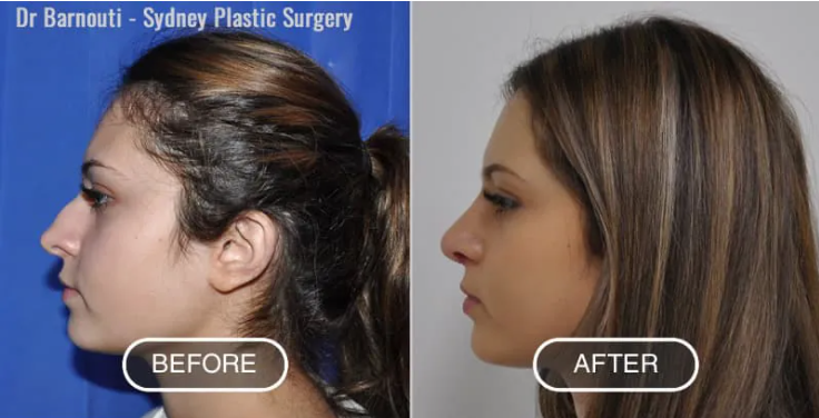 Surgery