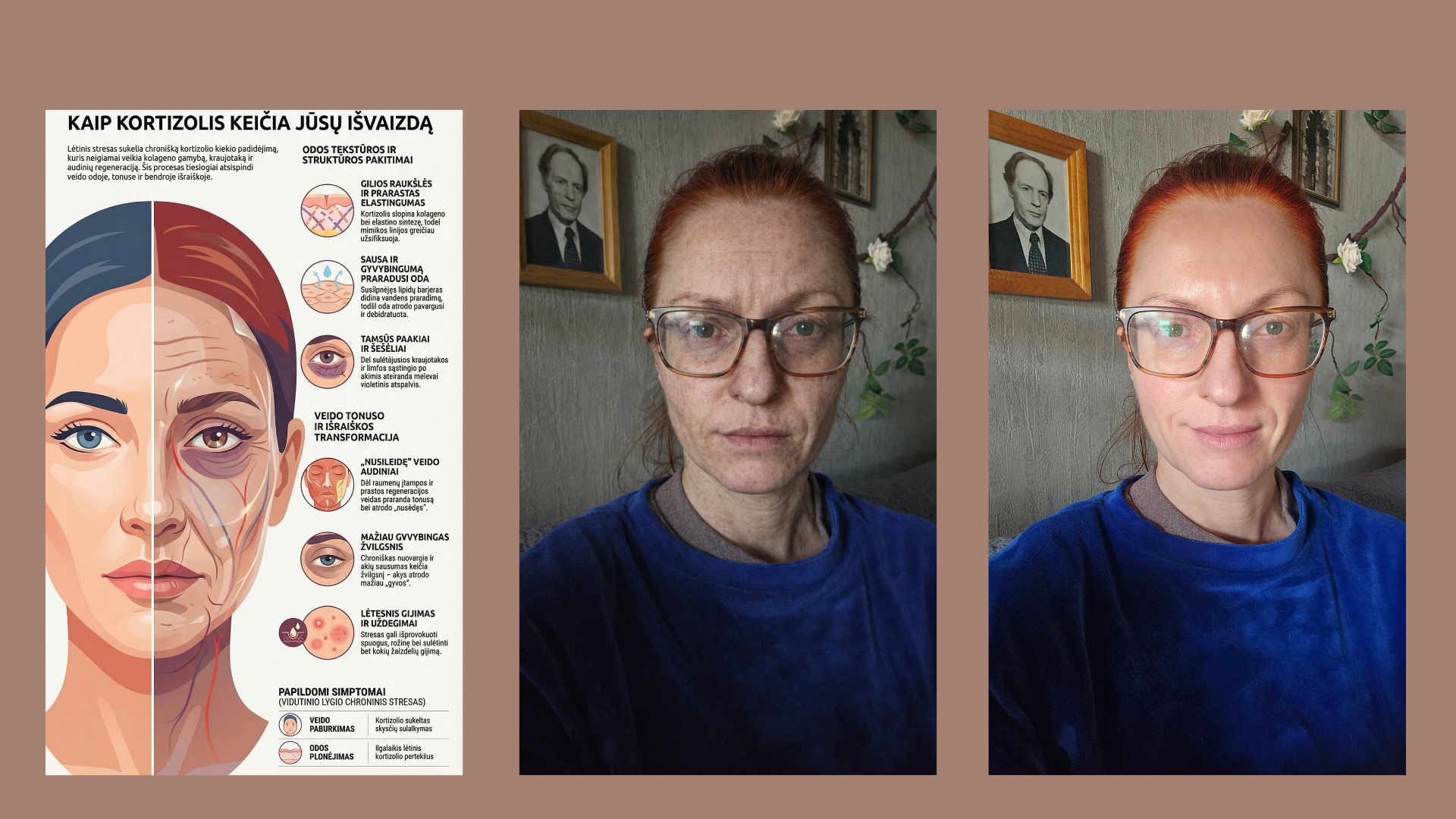 Kaip atrodytum po 10 metų gyvenimo su nuolatiniu stresu?