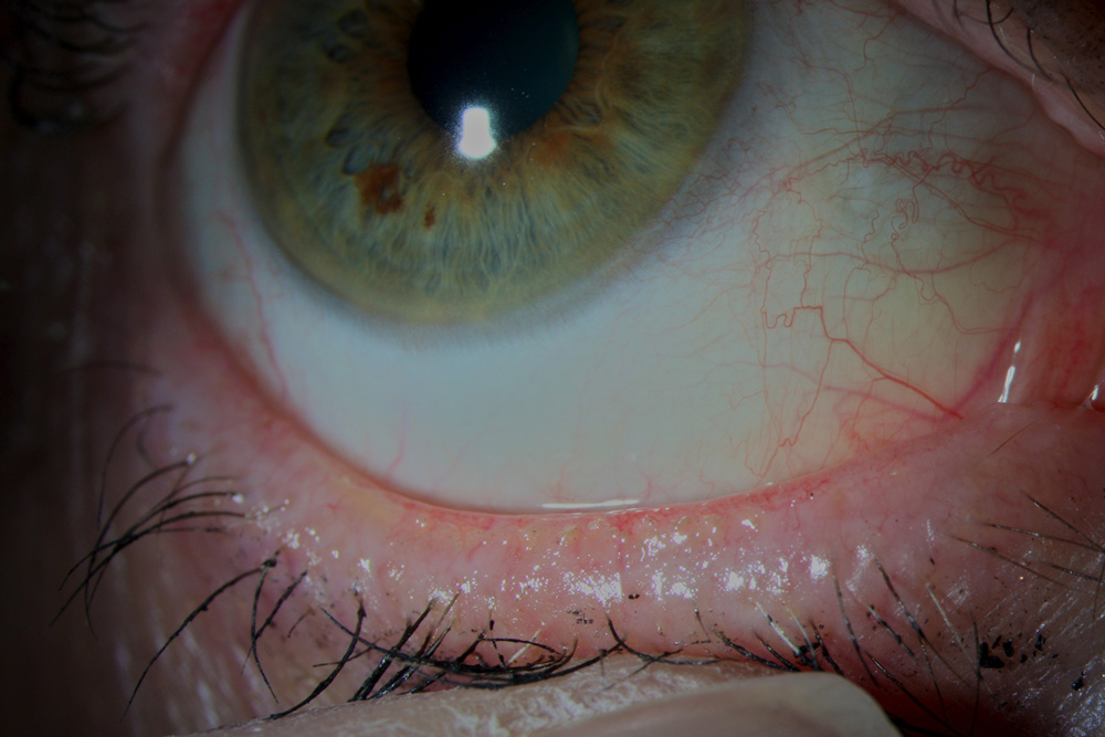 Writing medical fiction
