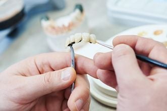 clinica dental en san miguel rigarci