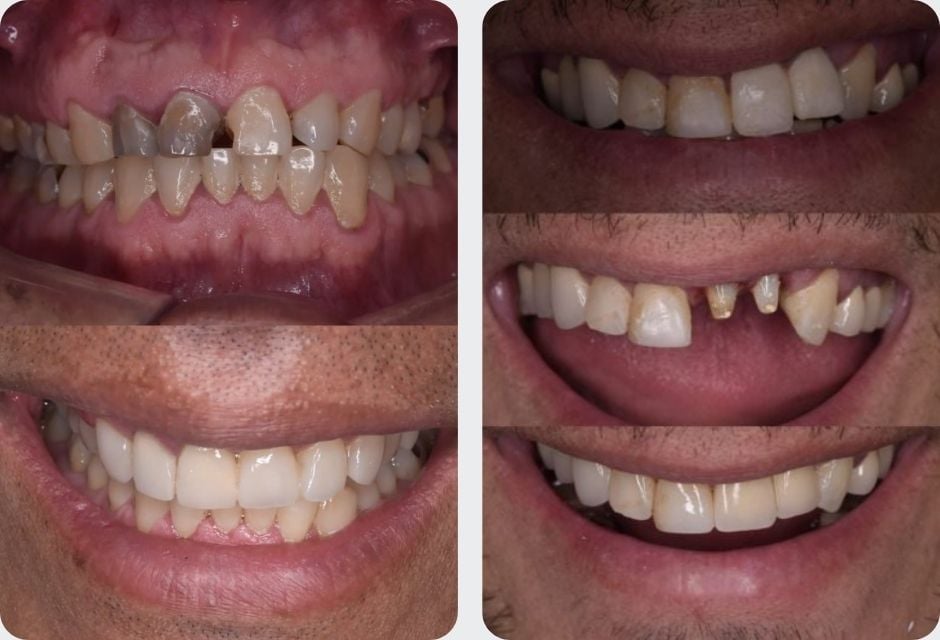 dentista en san miguel rigarci