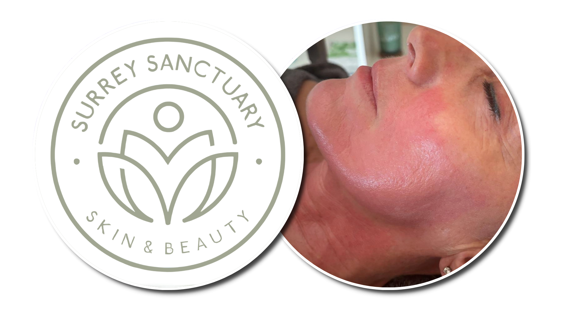 Why September Is the Perfect Time to Reset Your Skin