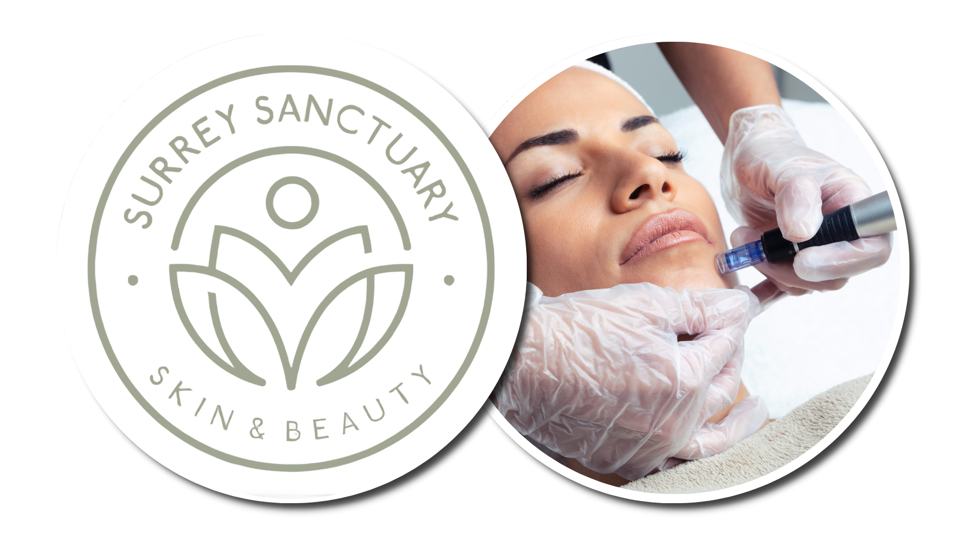 Microneedling Over 40: What You Need to Know