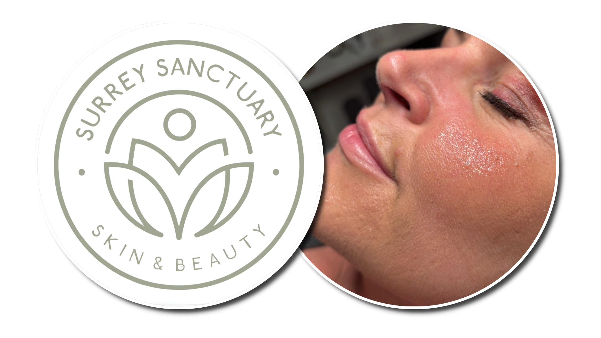 What Is a Skin Booster and Is It Right for You?