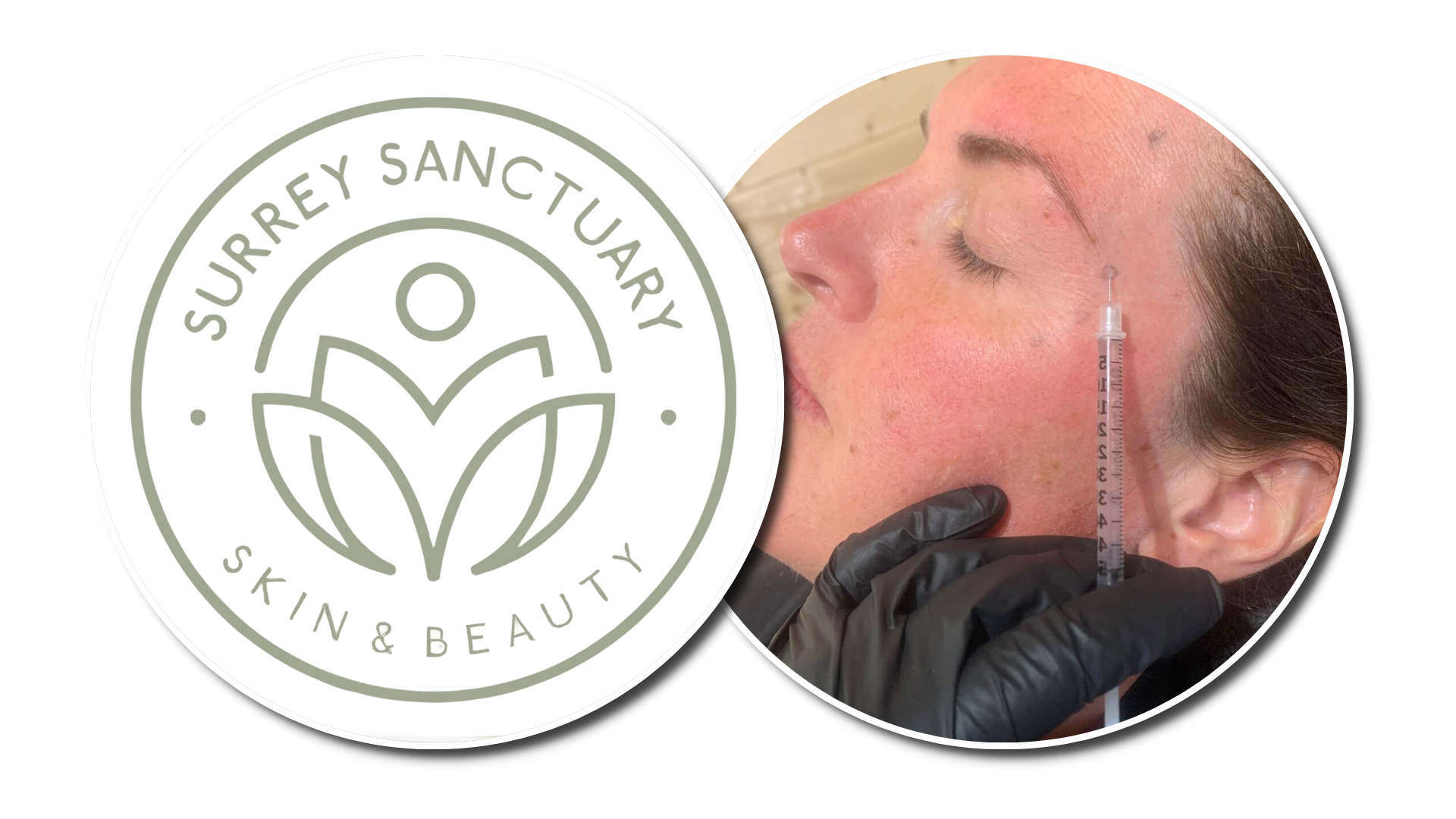 Anti-Wrinkle Treatments: Natural Results Without Looking Frozen